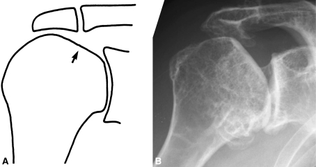 Fig. 5A–B