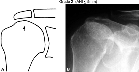 Fig. 2A–B