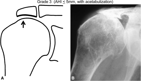 Fig. 3A–B