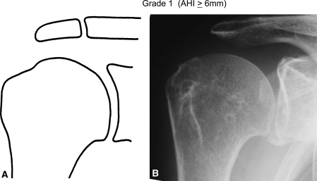 Fig. 1A–B