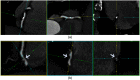 Fig. 10