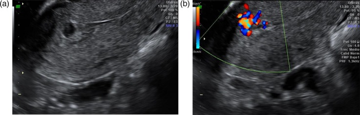 Figure 1