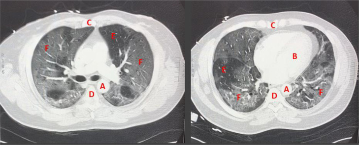 Fig 2