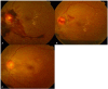 Fig. 3