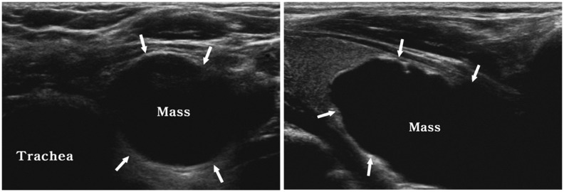 Fig. 17