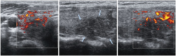 Fig. 14