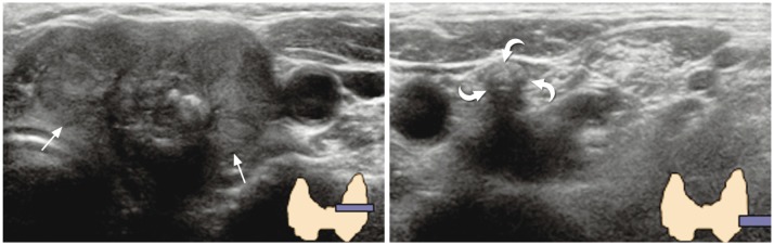 Fig. 11