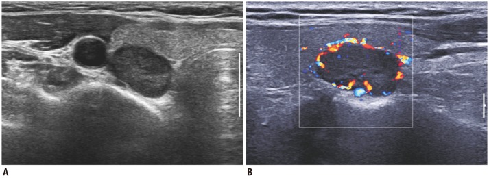 Fig. 18