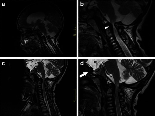 Fig. 18