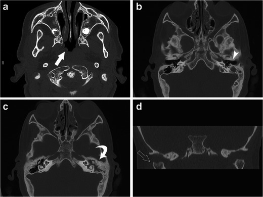 Fig. 12