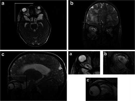 Fig. 21