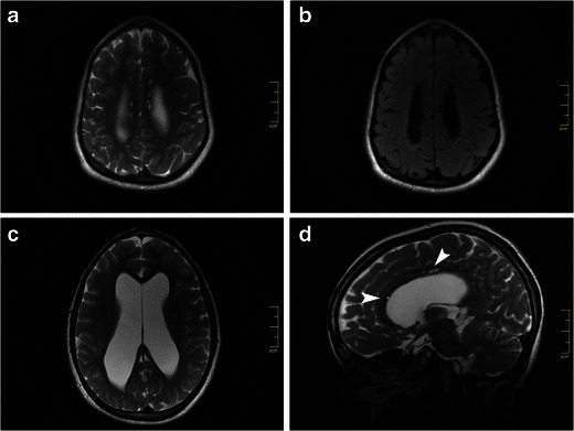 Fig. 14