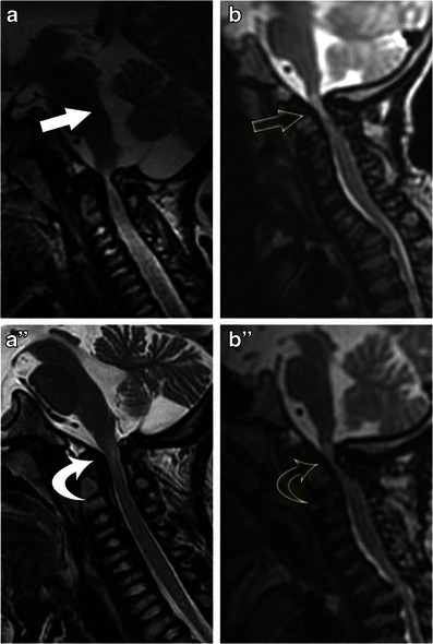 Fig. 19