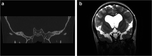 Fig. 23