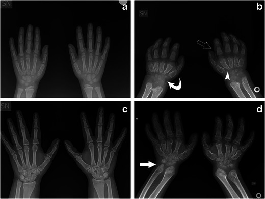 Fig. 11