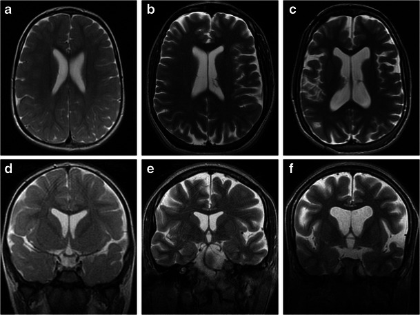 Fig. 16