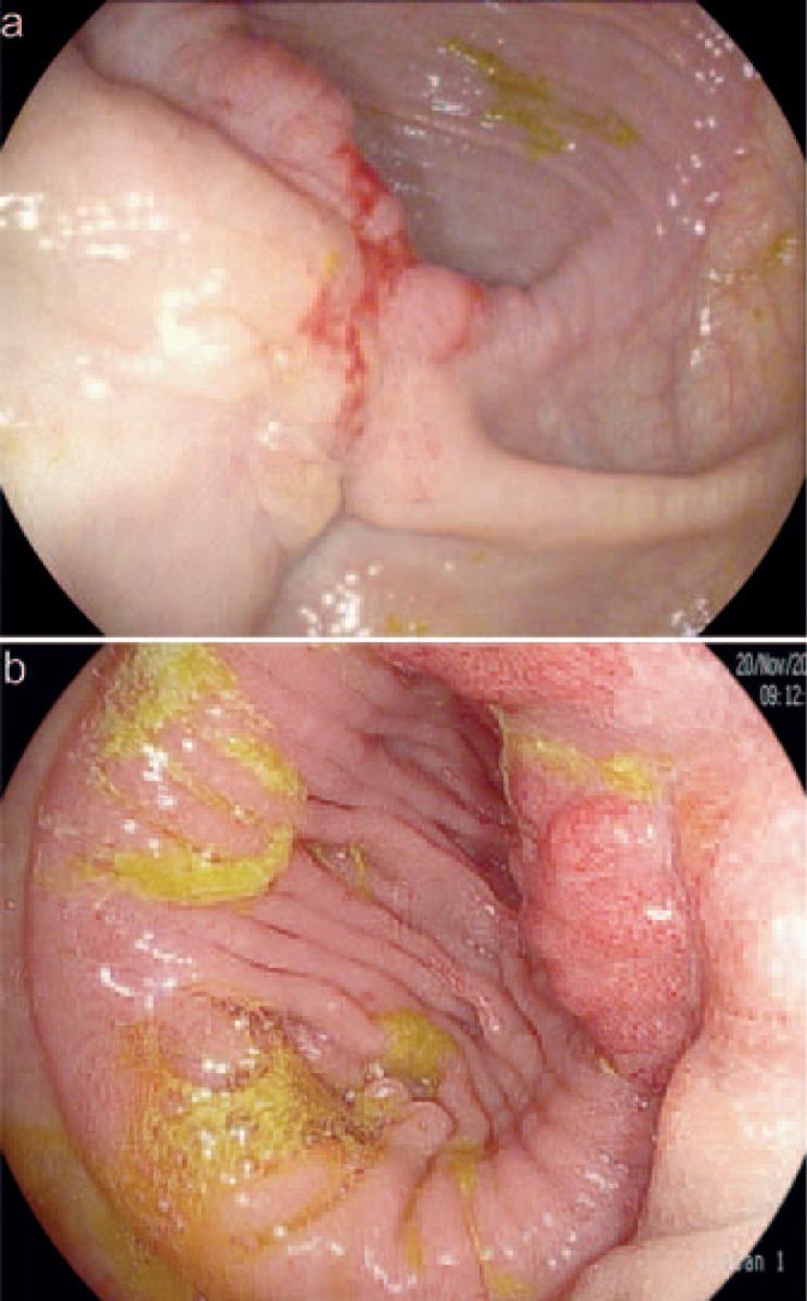 Fig. 5