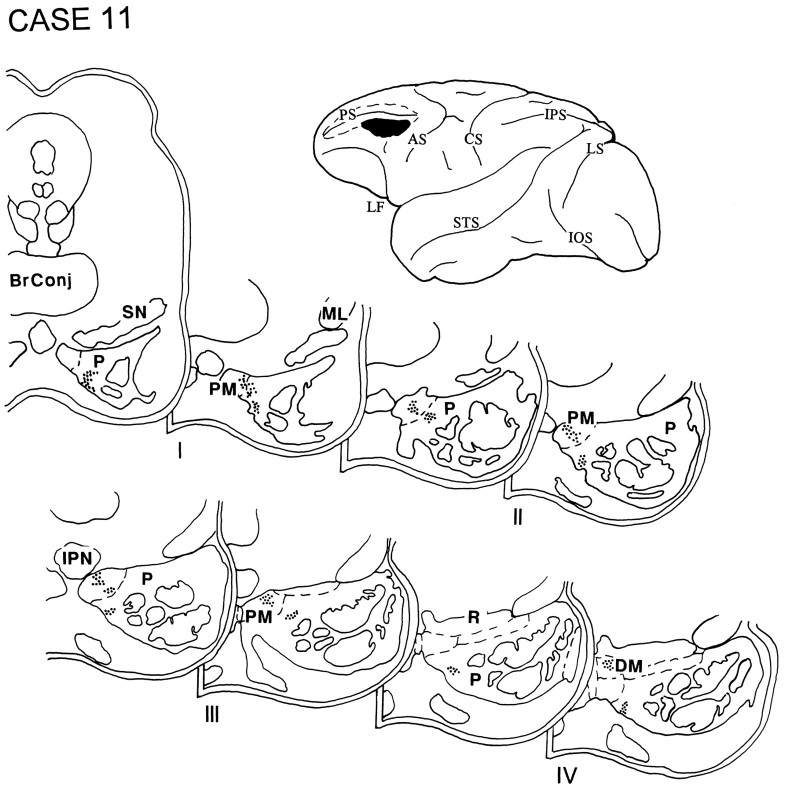 Fig. 12.