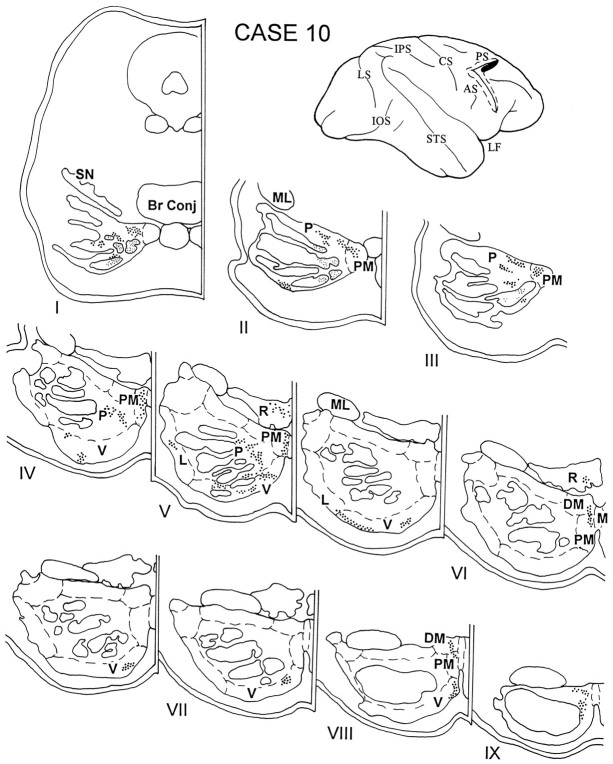 Fig. 11.