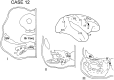 Fig. 13.