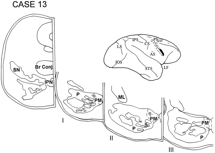 Fig. 14.