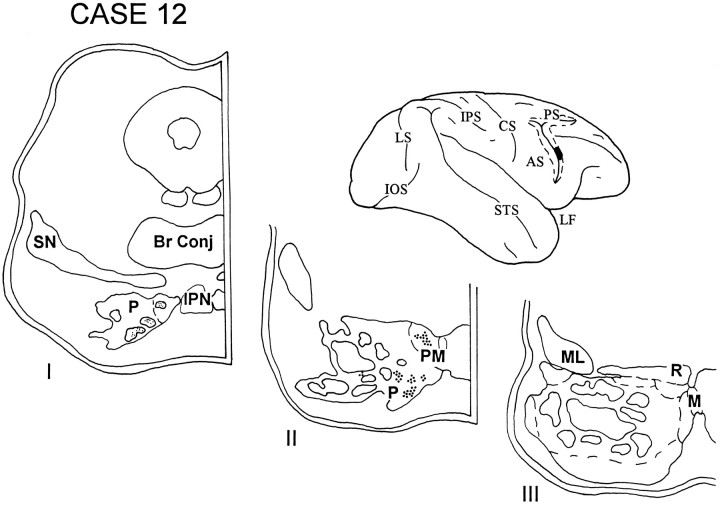 Fig. 13.