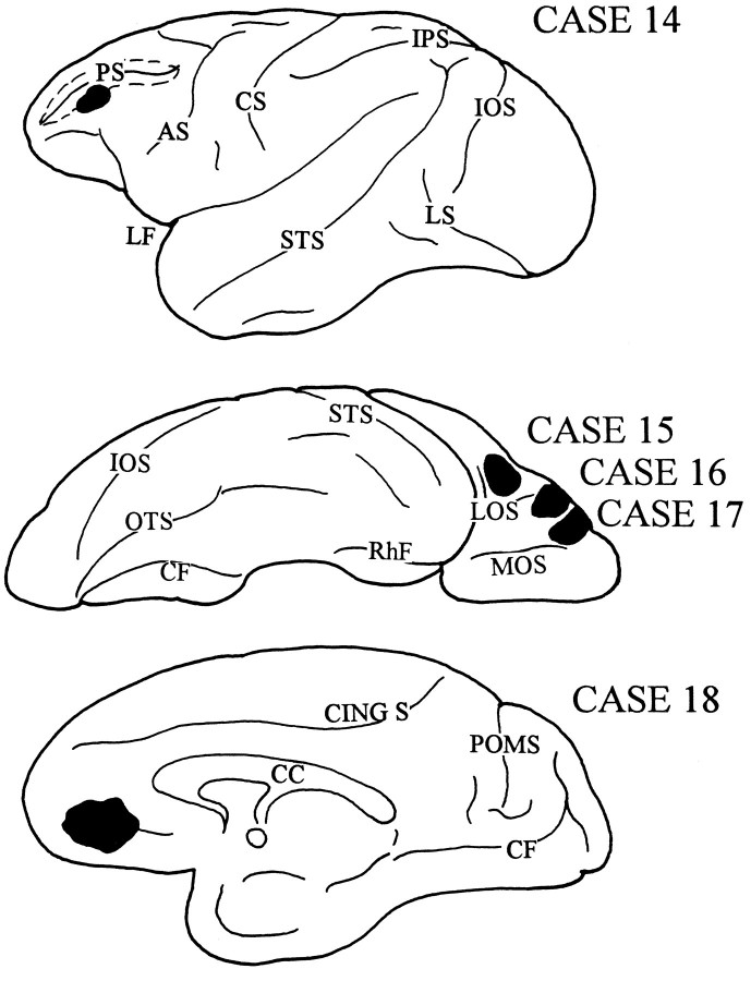 Fig. 15.