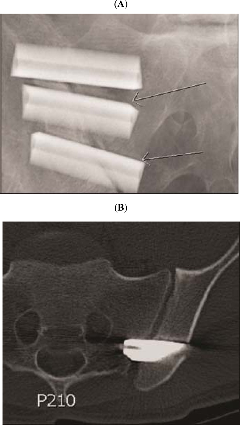 Fig. (3)