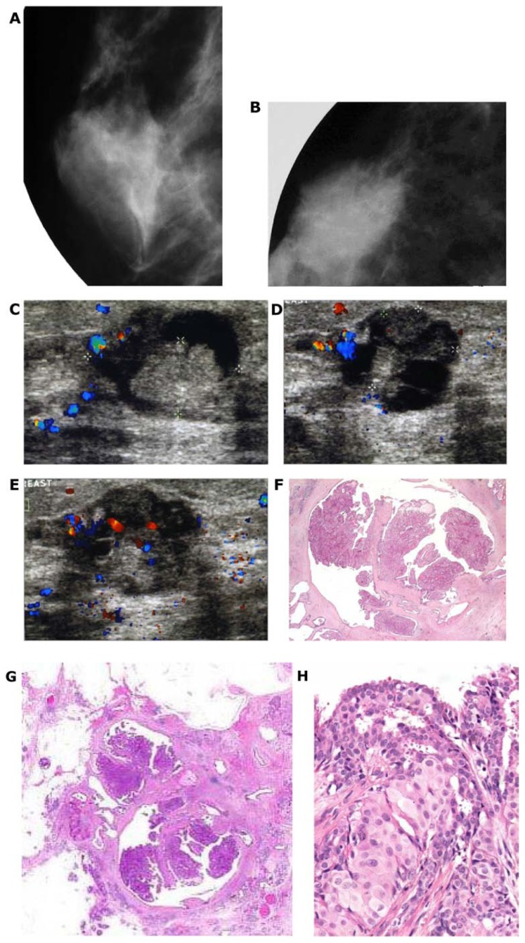 Figure 25