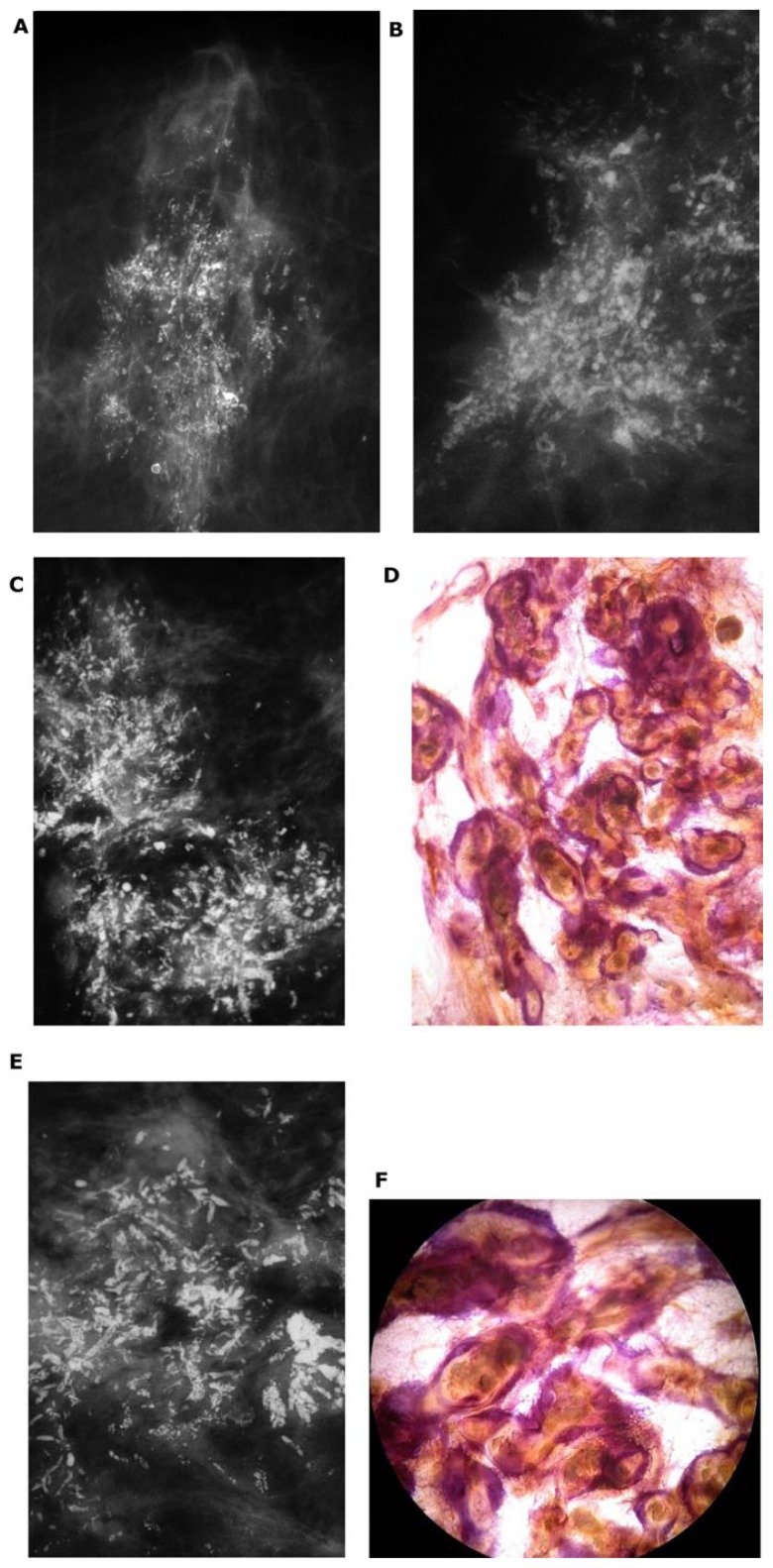 Figure 17