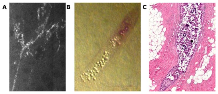 Figure 21