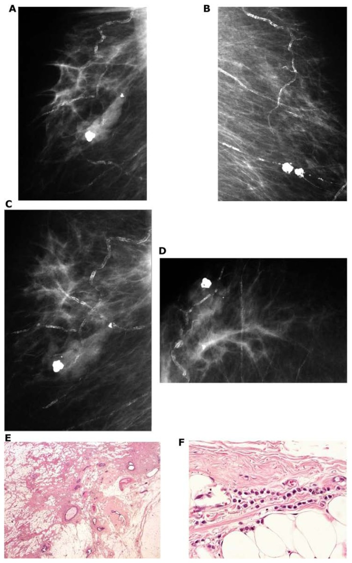 Figure 26