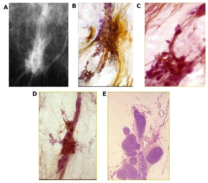 Figure 22