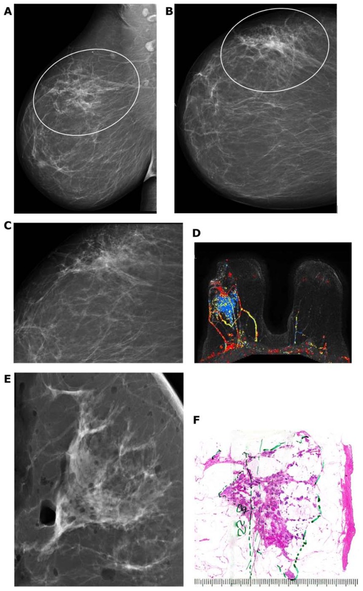 Figure 23