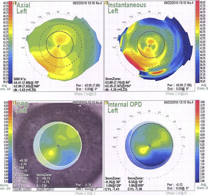 Fig. 1