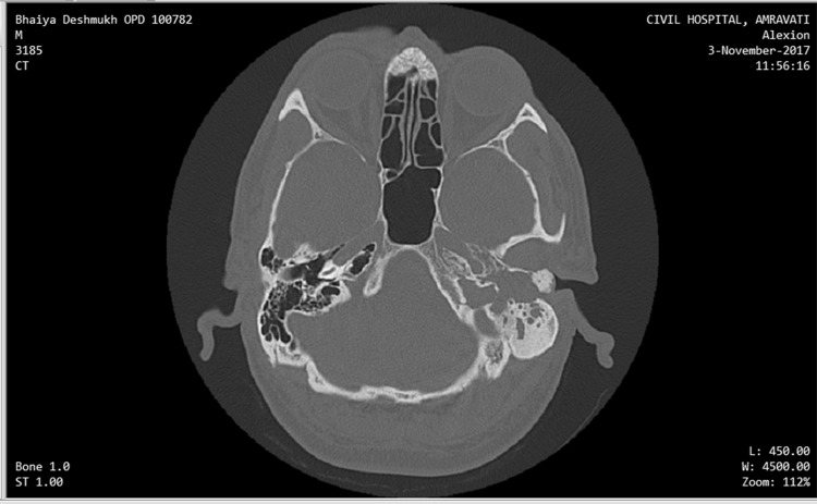 Fig. 1