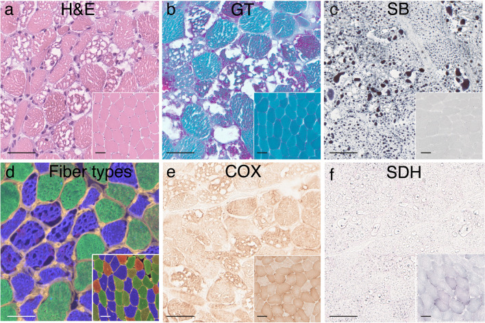 Fig. 2