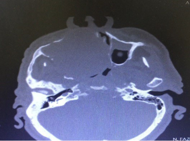 Fig. 10