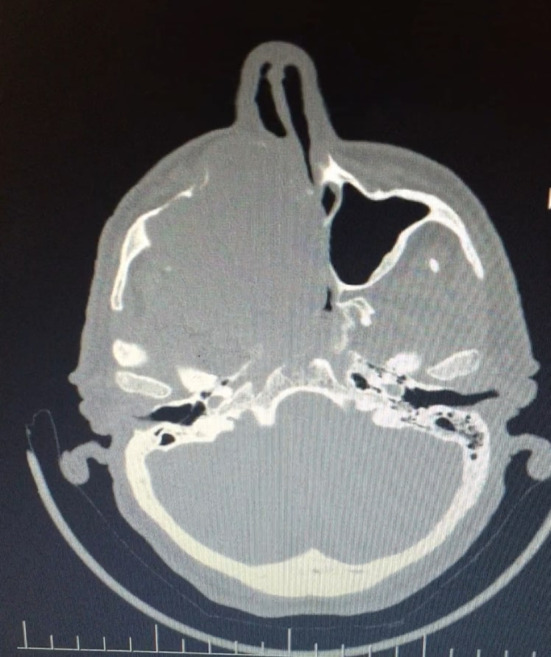 Fig. 2