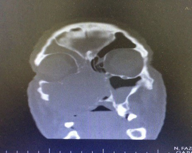 Fig. 9