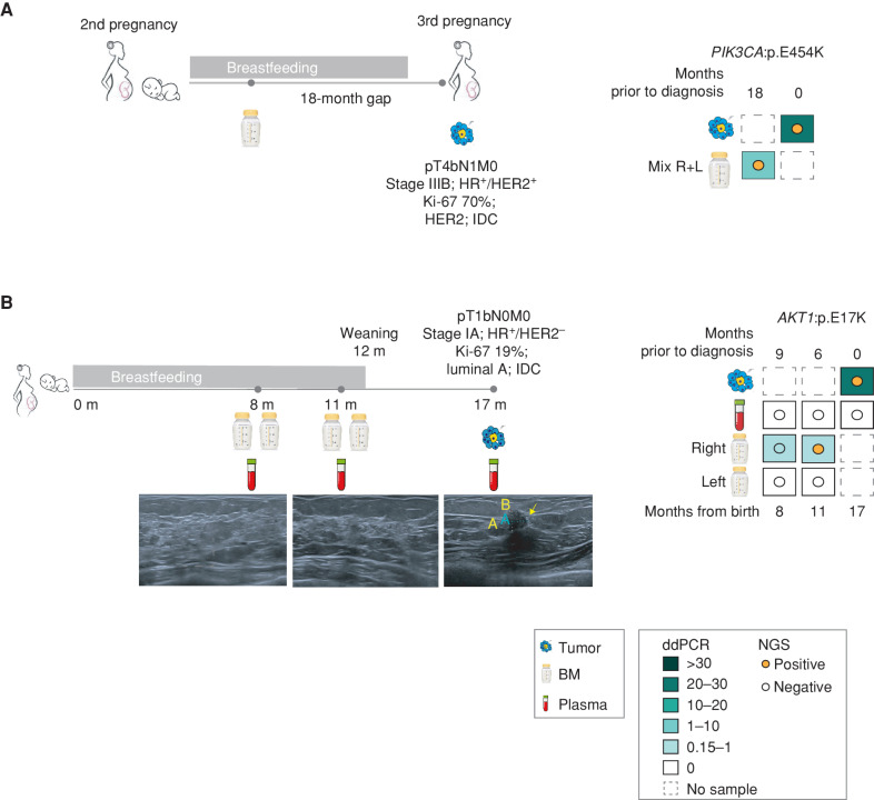 Figure 3. Early detection of breast cancer through BM ctDNA analysis. A, Description of case #1, timeline, sample collection, and test results by ddPCR and NGS. Patient 1 was diagnosed with PrBC during her third pregnancy. The patient provided a mixture of both breasts from the lactancy of a previous pregnancy and collected 18 months prior to diagnosis. HR, hormone receptor; R + L, right and left. B, Description of positive high-risk case BC-15, timeline (m = months from childbirth), sample collection, and the corresponding right breast ultrasound images. The third image taken at a 17-month time point corresponds to the time of clinical diagnosis. The yellow arrow points to the malignant lesion observed and its measurement by image (A = 7.4 mm; B = 6.4 mm). The different samples collected and test results obtained by ddPCR and NGS. Colored squares represent the MAF % of the pathogenic variant detected by ddPCR. Colored dots represent the detection of the same variant by NGS.