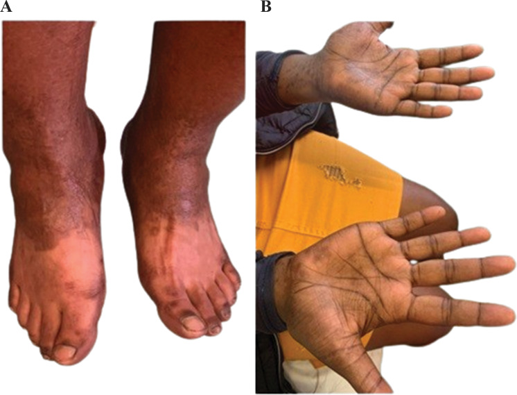 Fig. 2