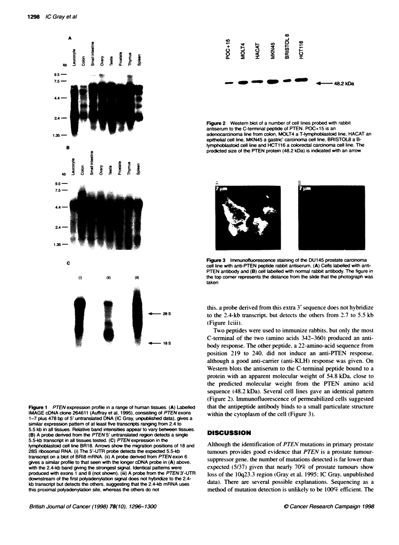 Mutation and expression analysis of the putative prostate tumour ...