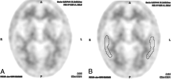 Fig 1.