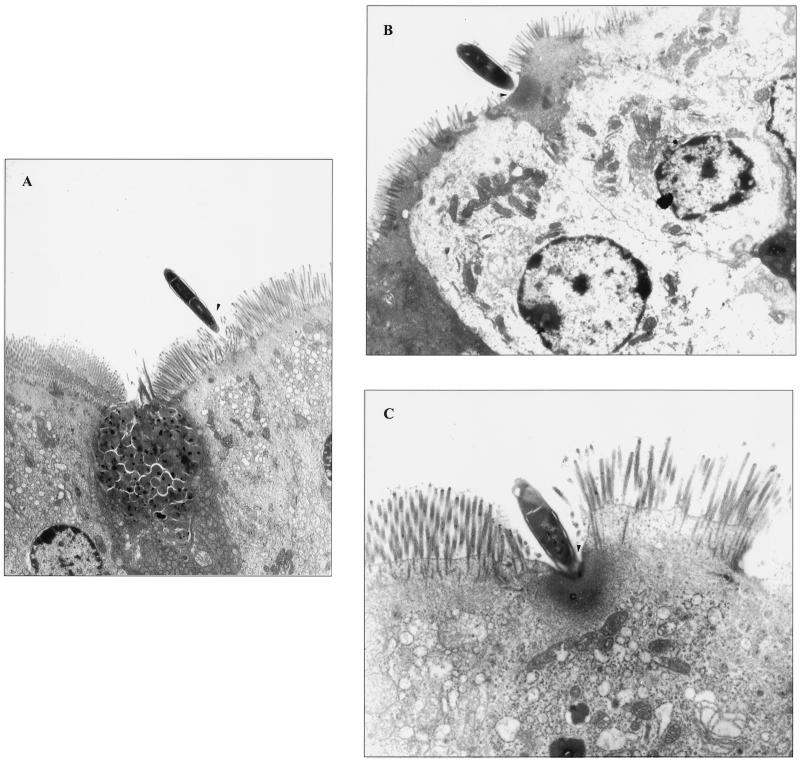 FIG. 1