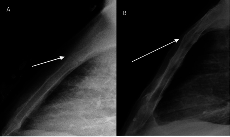 Fig. 13