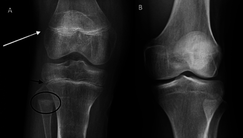 Fig. 11