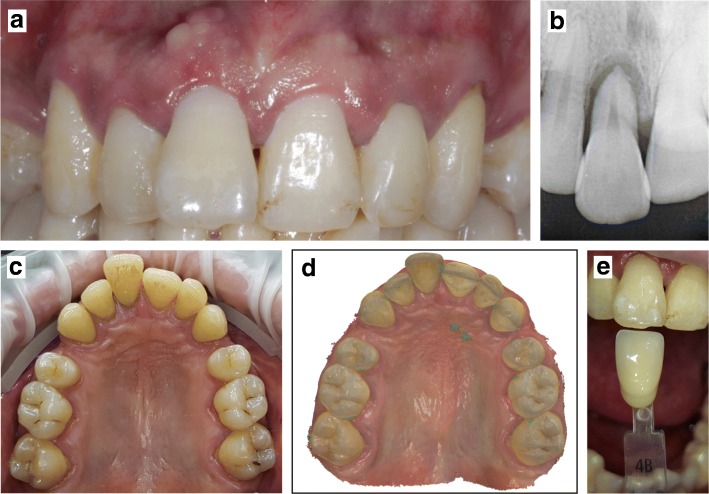 Fig. 1