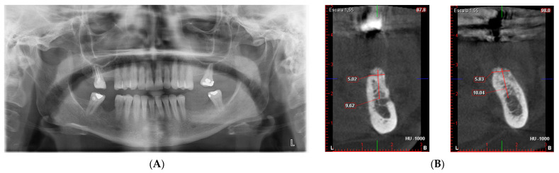 Figure 10