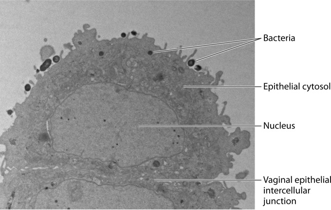 FIG 2